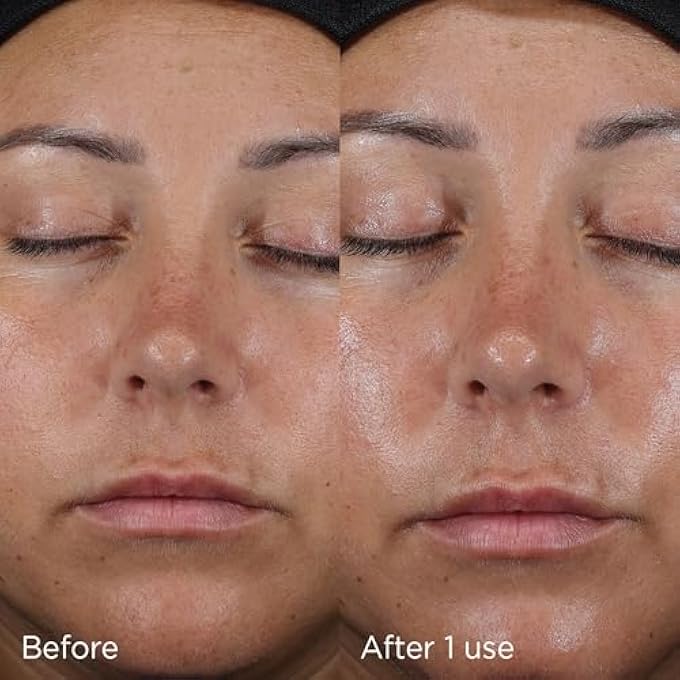 IMAGE SKINCARE , DAILY PREVENTION ULTRA DEFENSE FACE MOISTURISER SPF 50 SUNSCREEN LOTION, RADIANCE BOOSTING GLOW, NO WHITE CAST, 73 G - Image 4